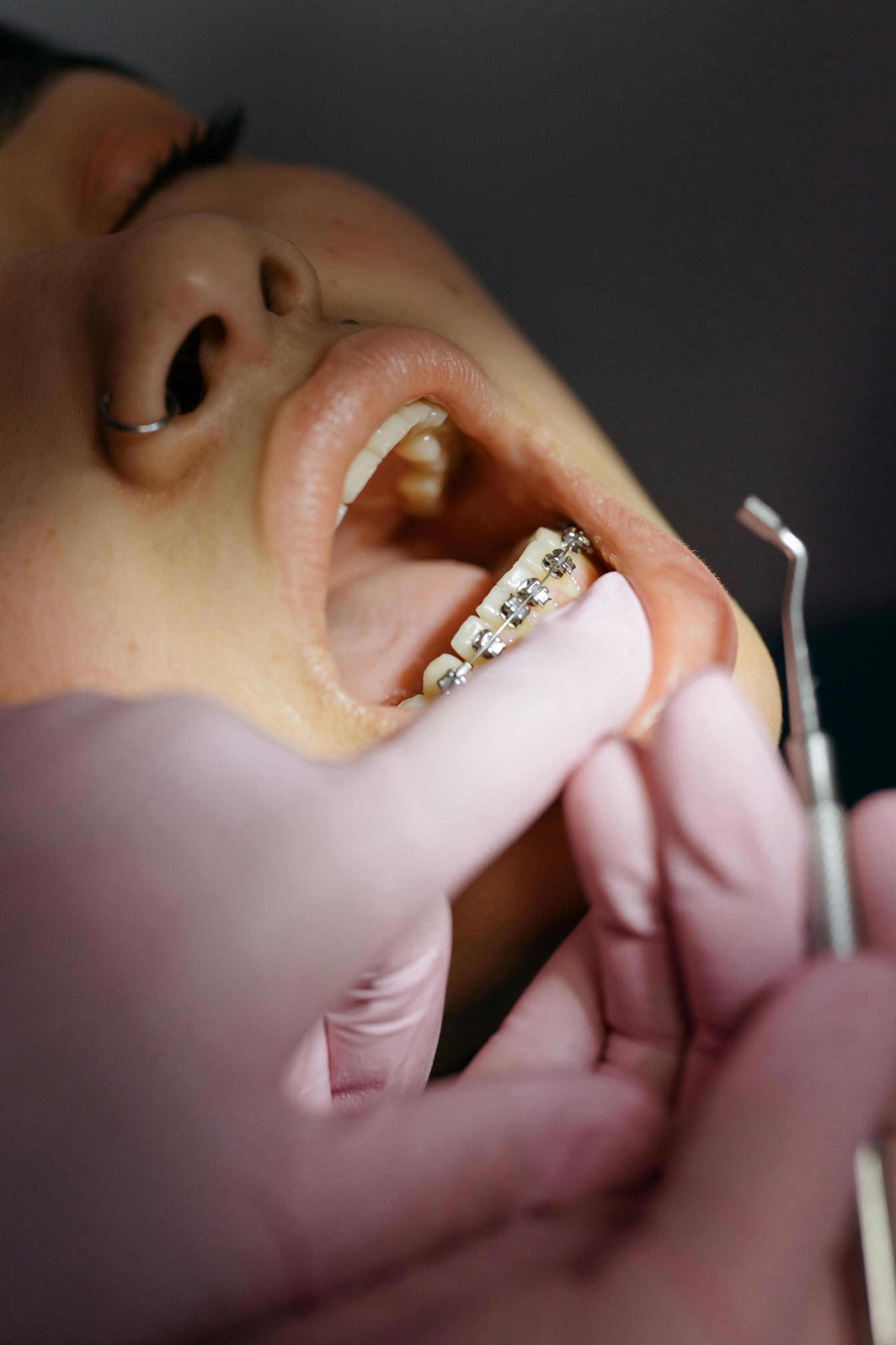 Orthodontics Orthodontics